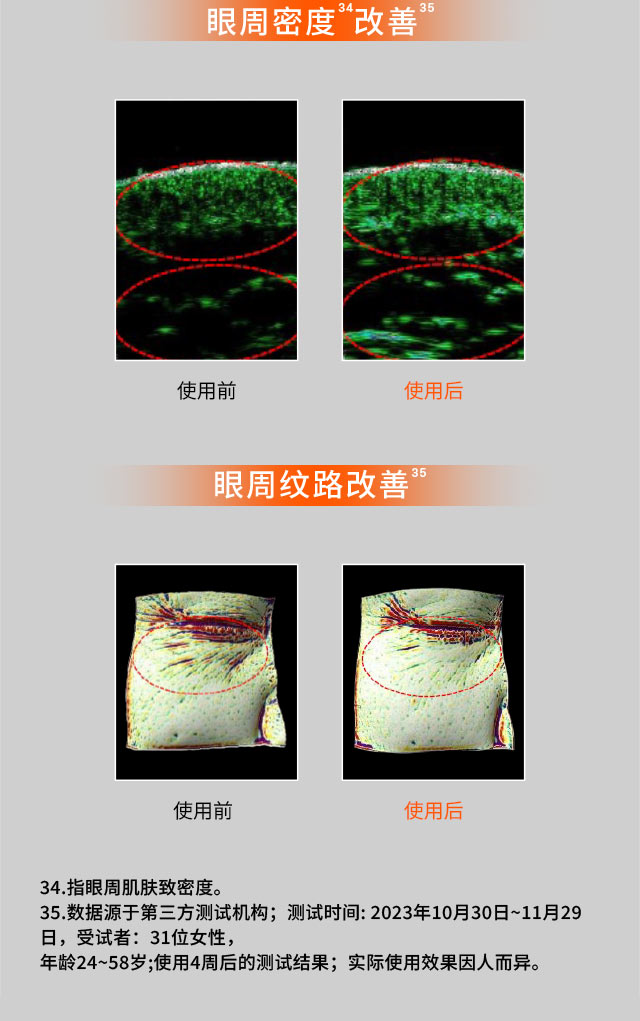 人生就是搏尊龙人参眼霜